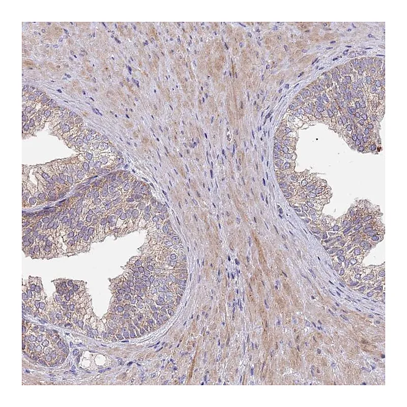Atlas Antibodies Anti-ABCC10 Antibody