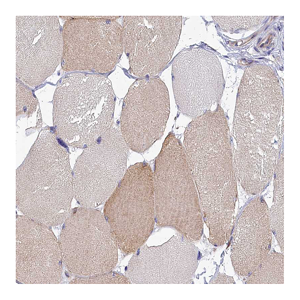 Atlas Antibodies Anti-ABCC12 Antibody