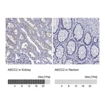 Atlas Antibodies Anti-ABCC2 Antibody