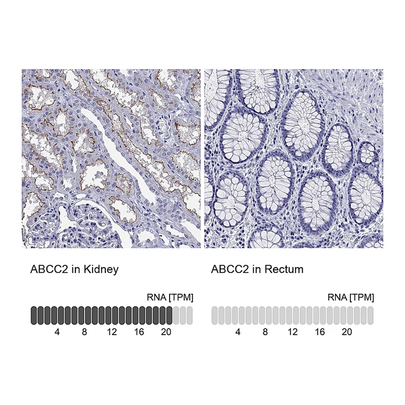 Atlas Antibodies Anti-ABCC2 Antibody