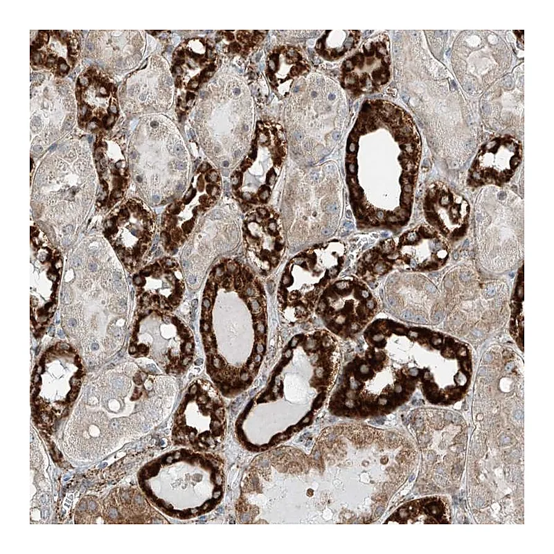 Atlas Antibodies Anti-ABCC11 Antibody