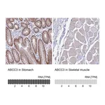 Atlas Antibodies Anti-ABCC3 Antibody