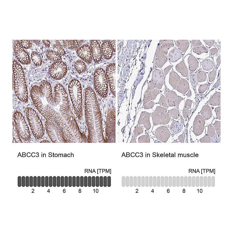 Atlas Antibodies Anti-ABCC3 Antibody