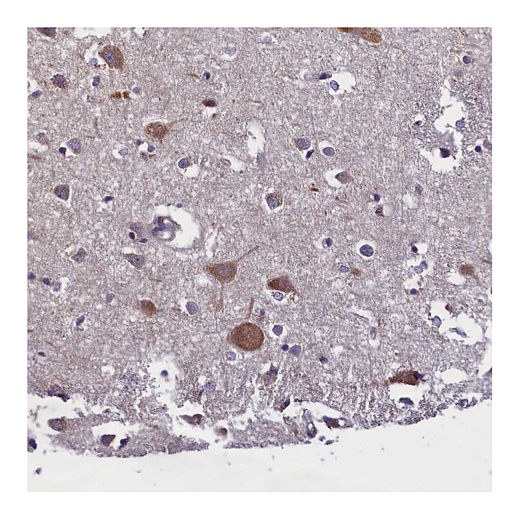 Atlas Antibodies Anti-ABCC8 Antibody
