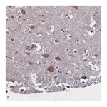 Atlas Antibodies Anti-ABCC8 Antibody