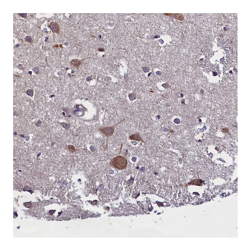 Atlas Antibodies Anti-ABCC8 Antibody