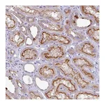 Atlas Antibodies Anti-ABCC5 Antibody