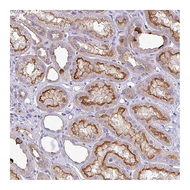 Atlas Antibodies Anti-ABCC5 Antibody