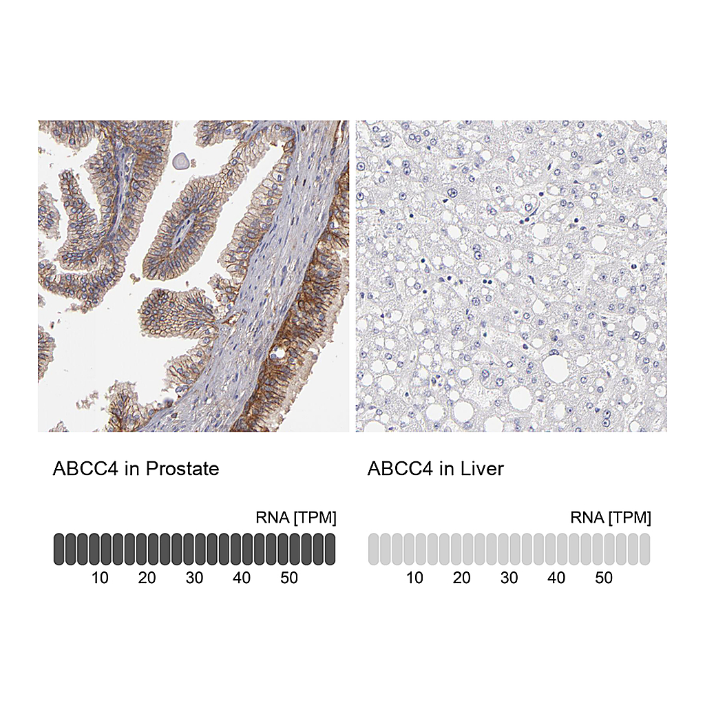 Atlas Antibodies Anti-ABCC4 Antibody
