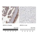 Atlas Antibodies Anti-ABCC4 Antibody