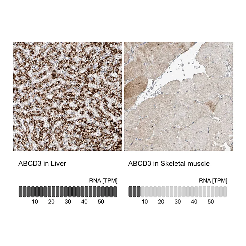 Atlas Antibodies Anti-ABCD3 Antibody