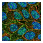 Atlas Antibodies Anti-ABCC5 Antibody