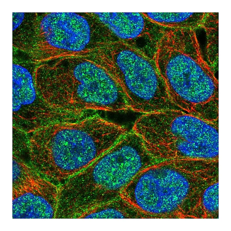 Atlas Antibodies Anti-ABCC5 Antibody