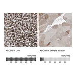 Atlas Antibodies Anti-ABCD3 Antibody