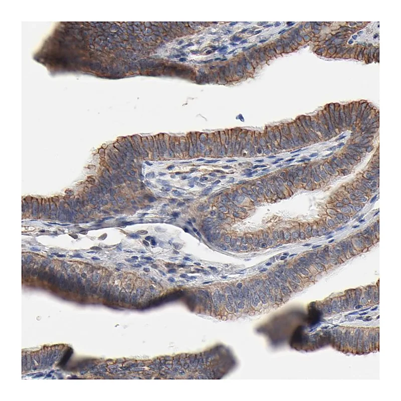 Atlas Antibodies Anti-ABCD4 Antibody