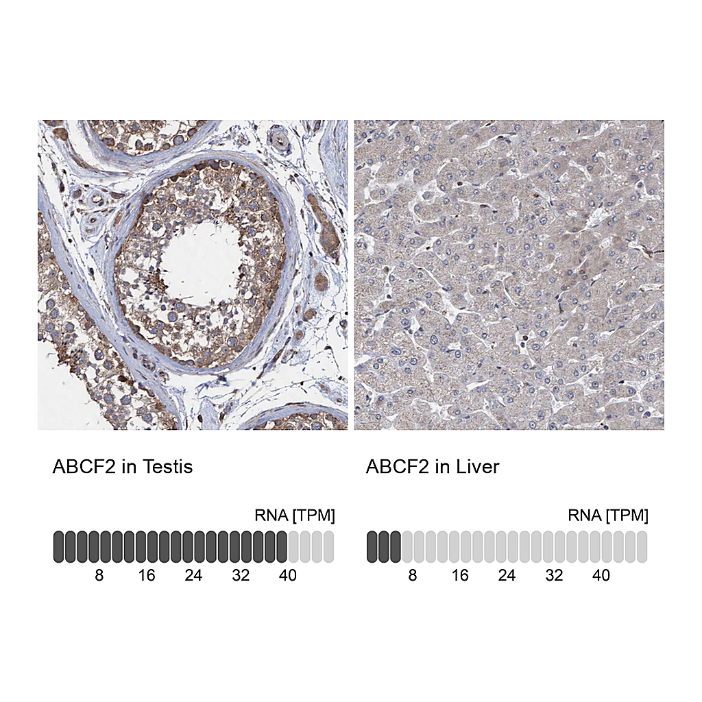 Atlas Antibodies Anti-ABCF2 Antibody
