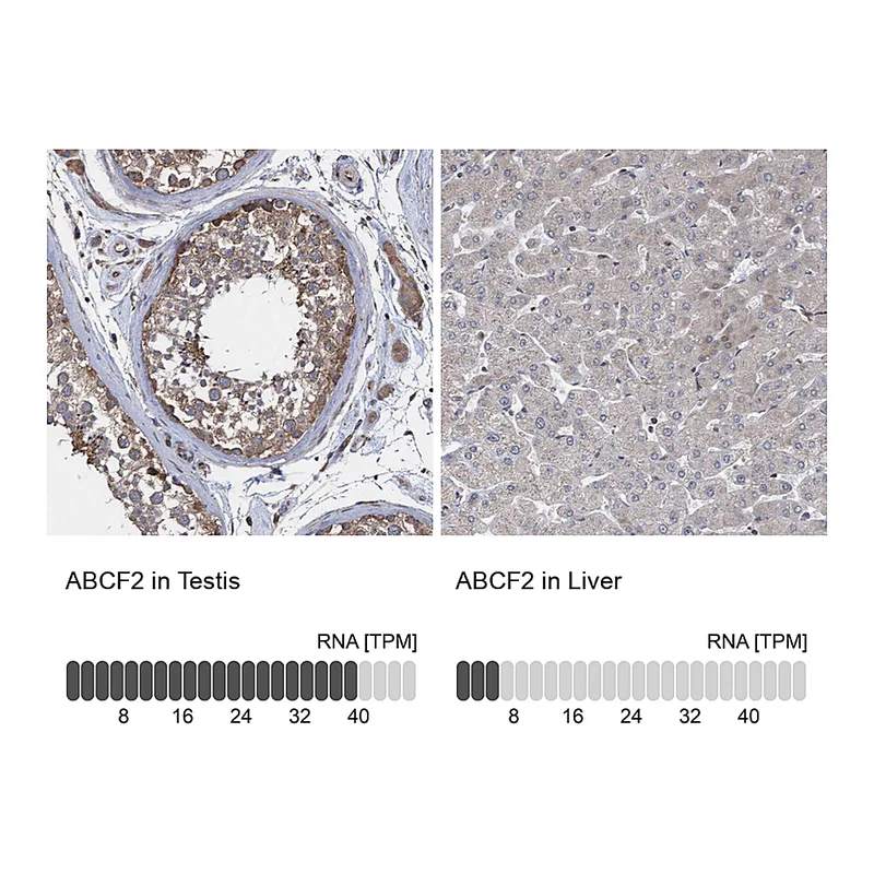 Atlas Antibodies Anti-ABCF2 Antibody