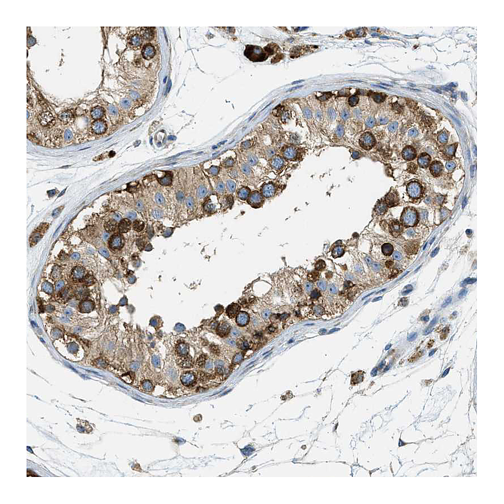 Atlas Antibodies Anti-ABCF1 Antibody
