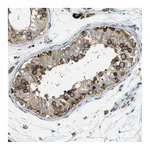 Atlas Antibodies Anti-ABCF1 Antibody