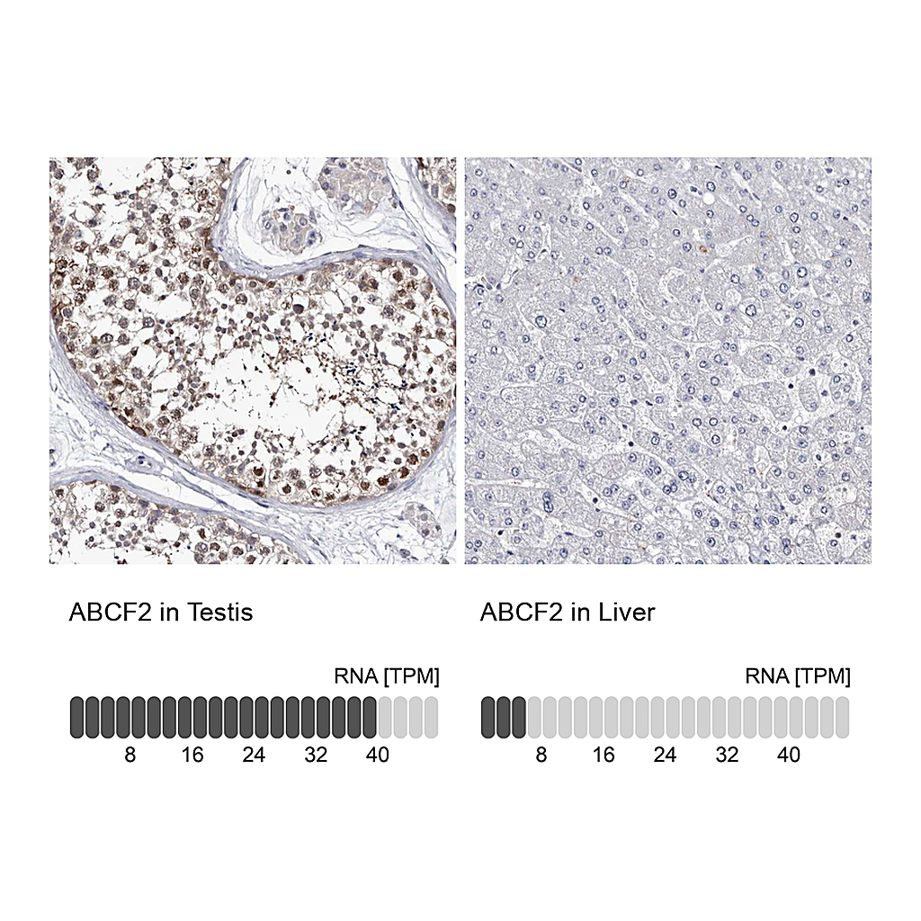Atlas Antibodies Anti-ABCF2 Antibody