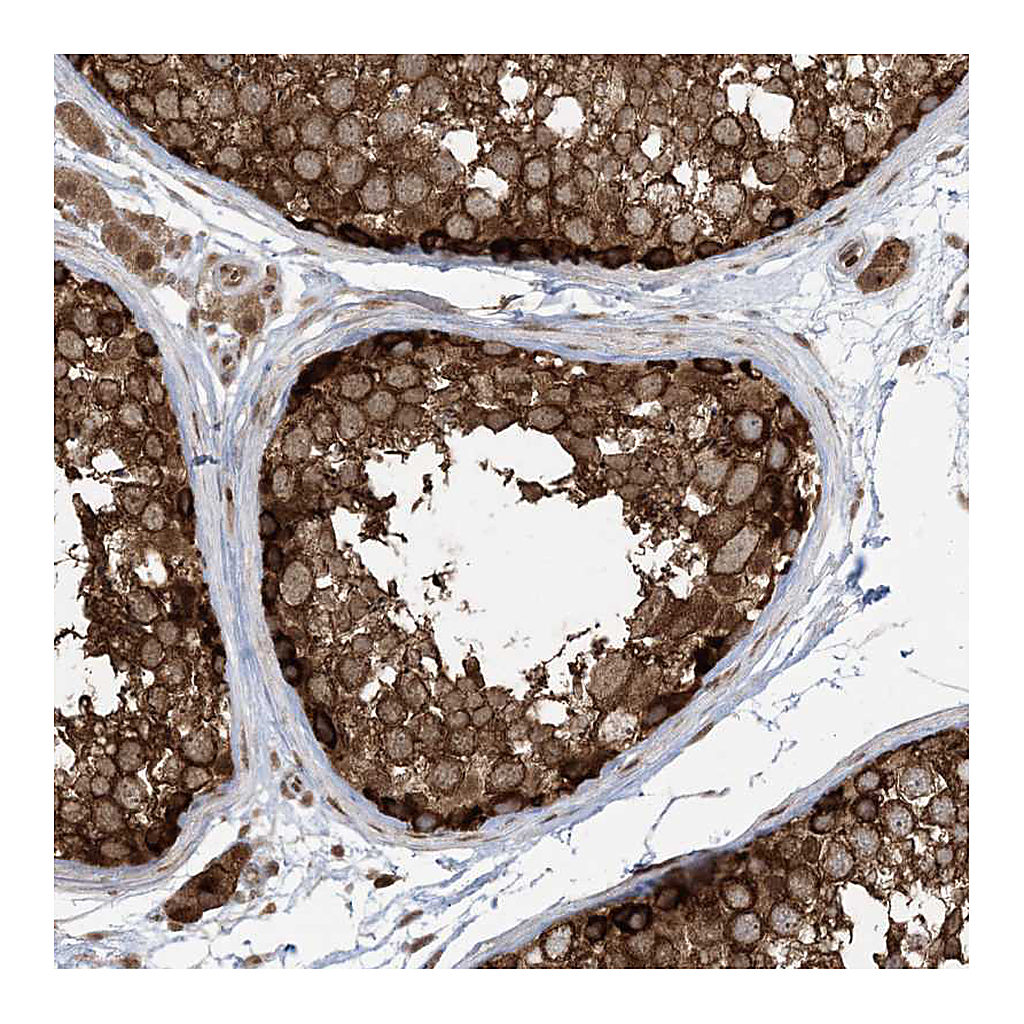 Atlas Antibodies Anti-ABCF3 Antibody