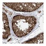 Atlas Antibodies Anti-ABCF3 Antibody