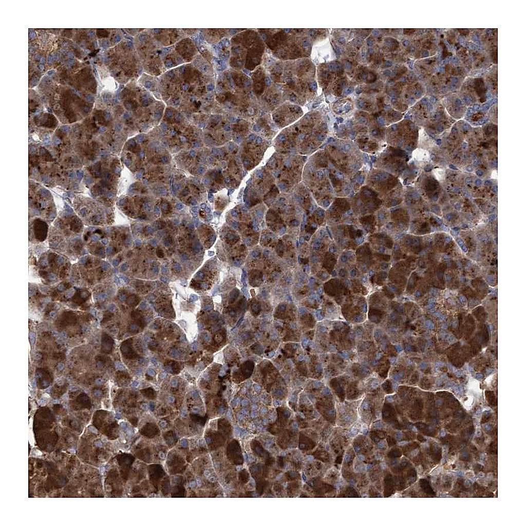 Atlas Antibodies Anti-ABCF2 Antibody