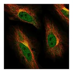 Atlas Antibodies Anti-ABCG1 Antibody