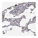 Atlas Antibodies Anti-ABCG1 Antibody