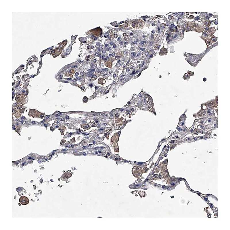 Atlas Antibodies Anti-ABCG1 Antibody