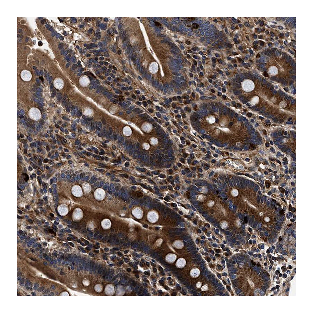 Atlas Antibodies Anti-ABCG8 Antibody
