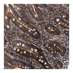 Atlas Antibodies Anti-ABCG8 Antibody