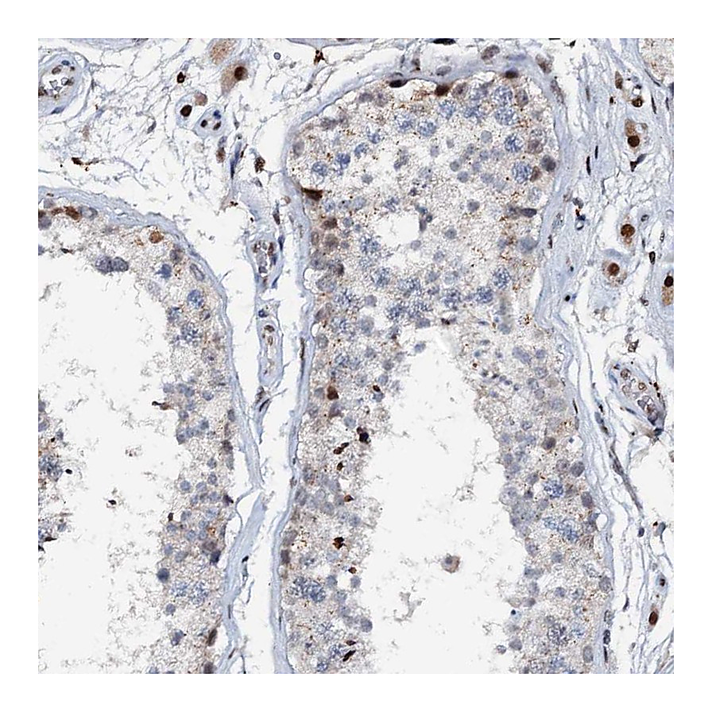 Atlas Antibodies Anti-ABCG4 Antibody