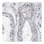 Atlas Antibodies Anti-ABCG4 Antibody