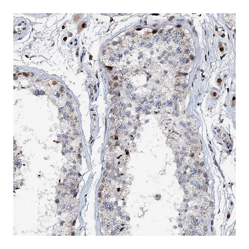 Atlas Antibodies Anti-ABCG4 Antibody