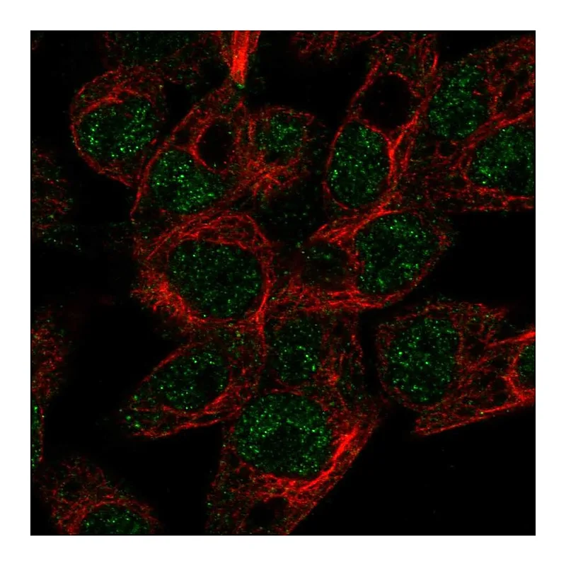 Atlas Antibodies Anti-ABCG5 Antibody