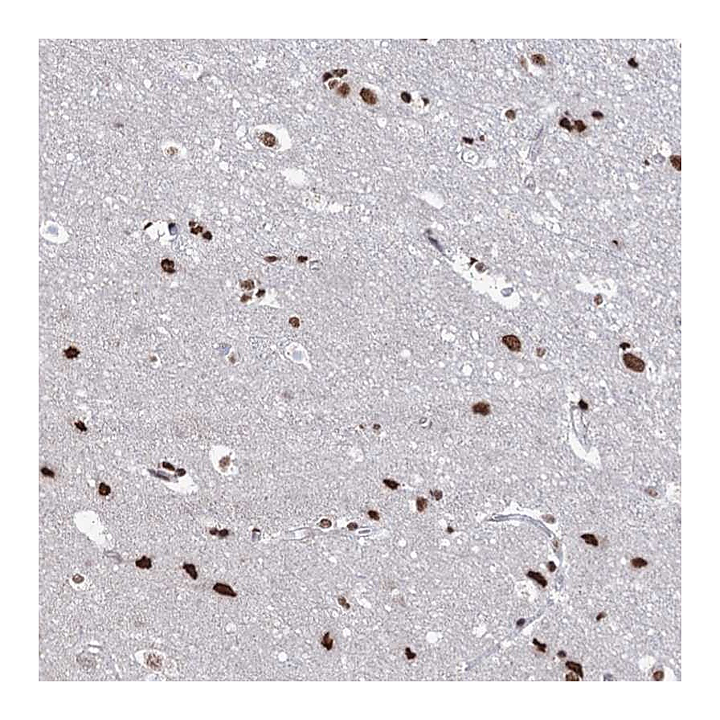 Atlas Antibodies Anti-ABHD10 Antibody