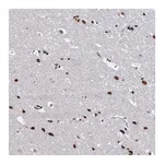 Atlas Antibodies Anti-ABHD10 Antibody