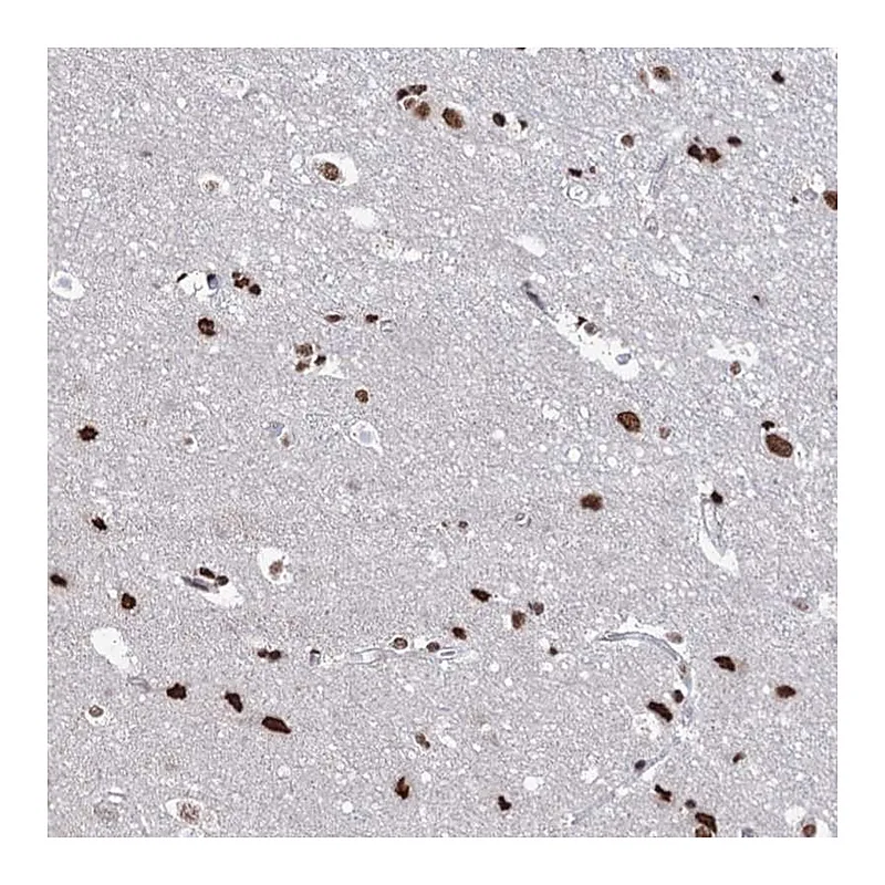 Atlas Antibodies Anti-ABHD10 Antibody