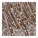 Atlas Antibodies Anti-ABHD11 Antibody