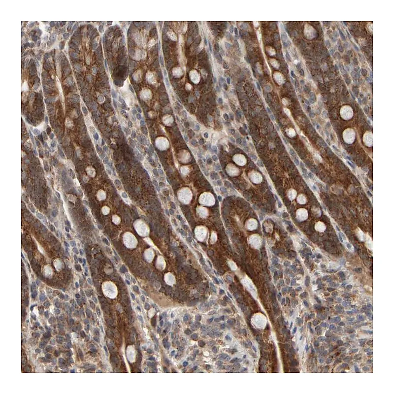 Atlas Antibodies Anti-ABHD11 Antibody