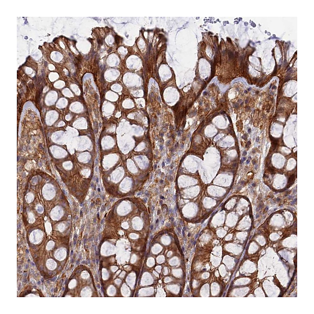 Atlas Antibodies Anti-ABHD1 Antibody