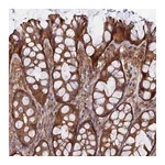 Atlas Antibodies Anti-ABHD1 Antibody