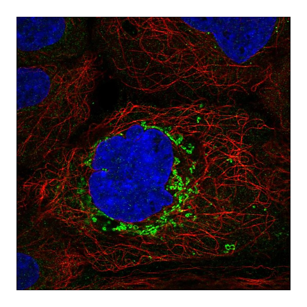 Atlas Antibodies Anti-ABHD10 Antibody