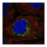 Atlas Antibodies Anti-ABHD10 Antibody