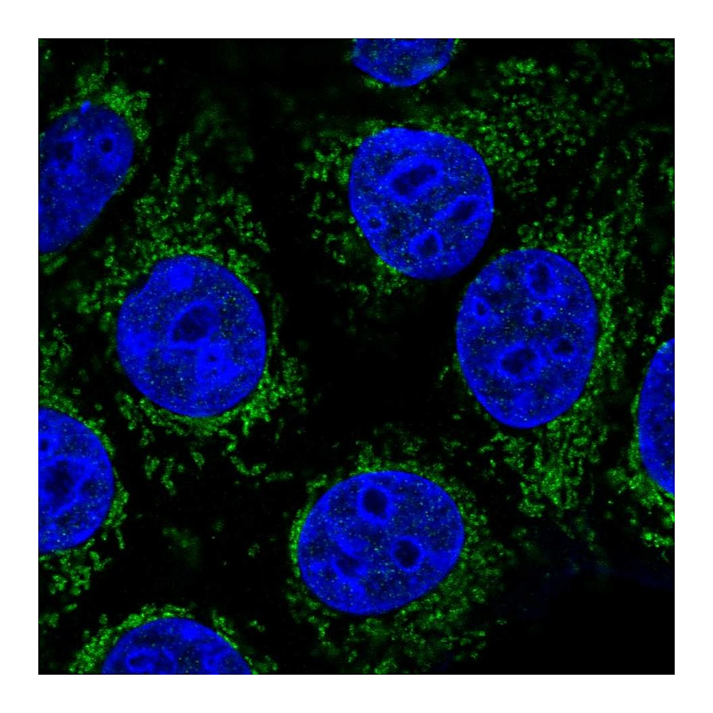 Atlas Antibodies Anti-ABHD11 Antibody