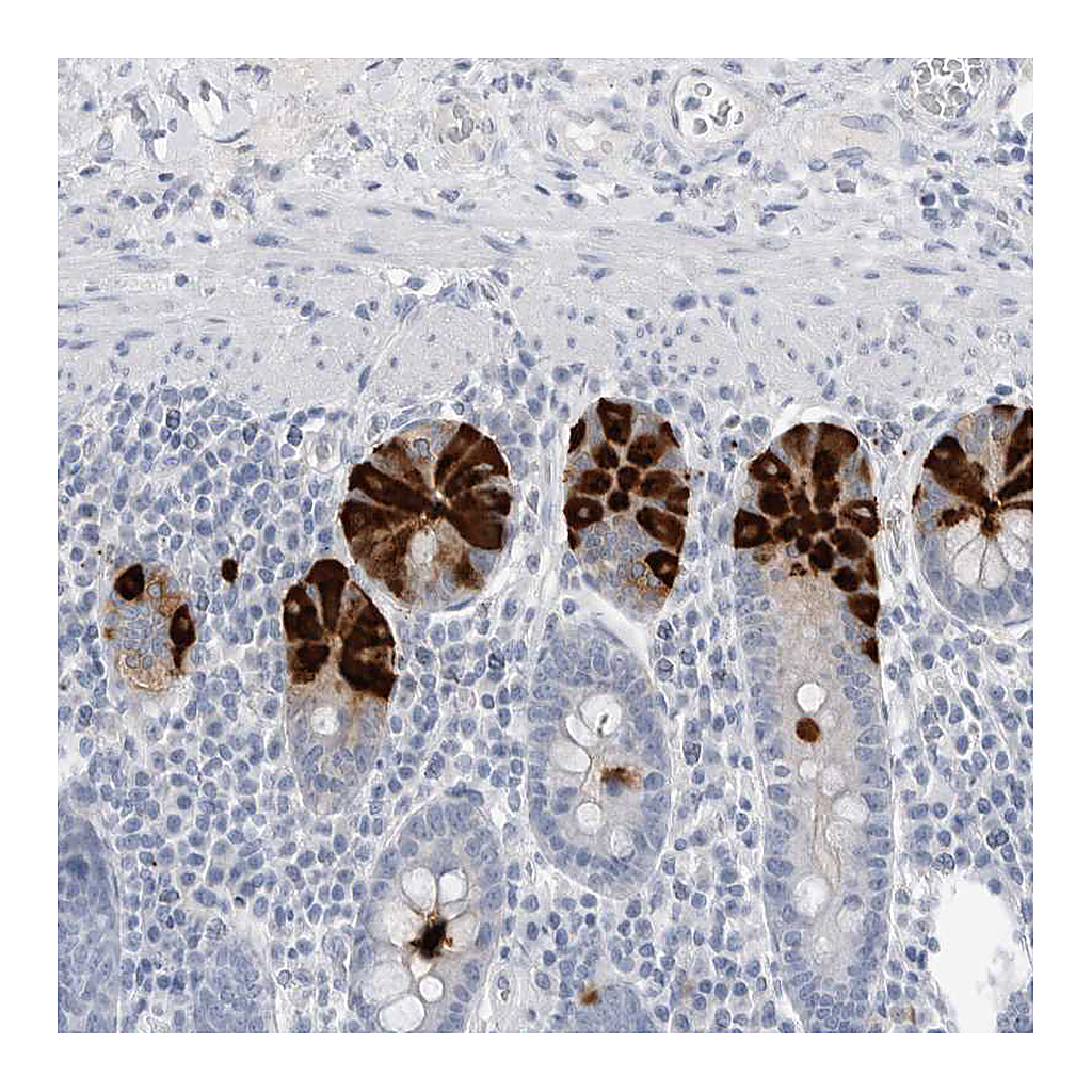 Atlas Antibodies Anti-ABHD12 Antibody