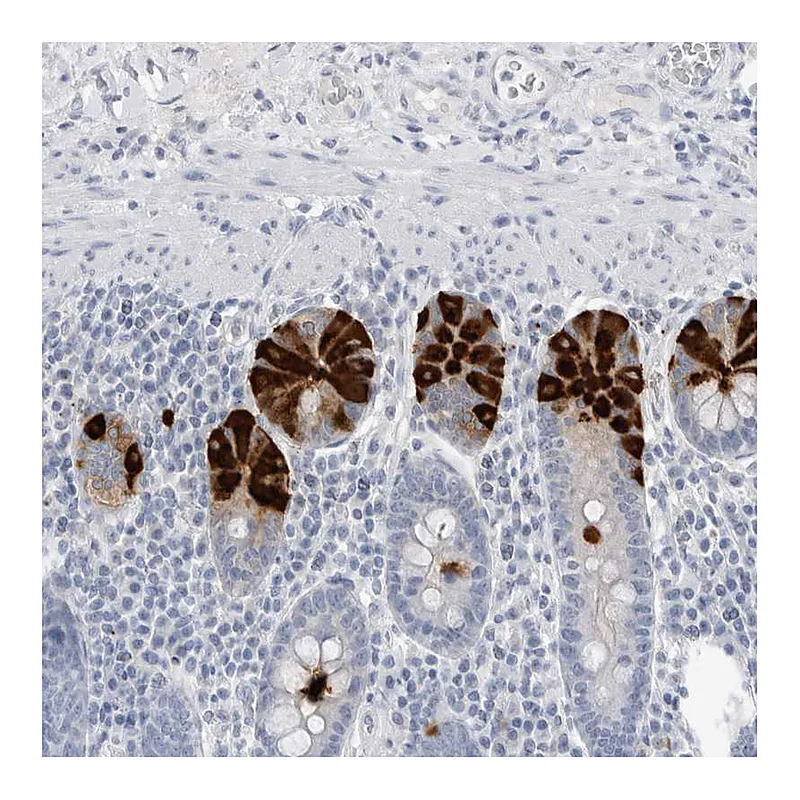 Atlas Antibodies Anti-ABHD12 Antibody