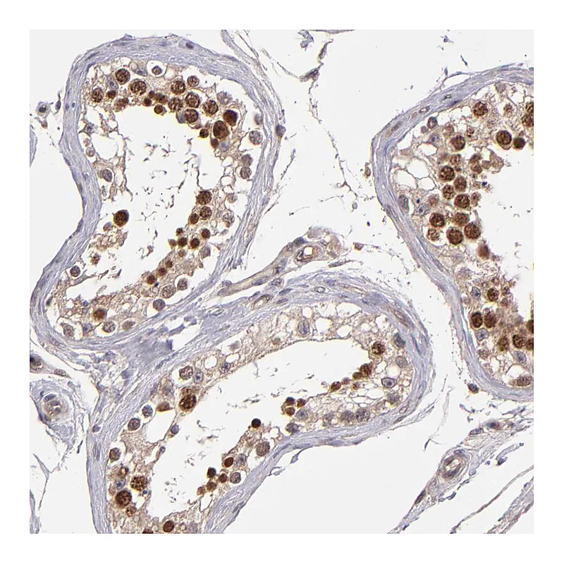 Atlas Antibodies Anti-ABHD12B Antibody