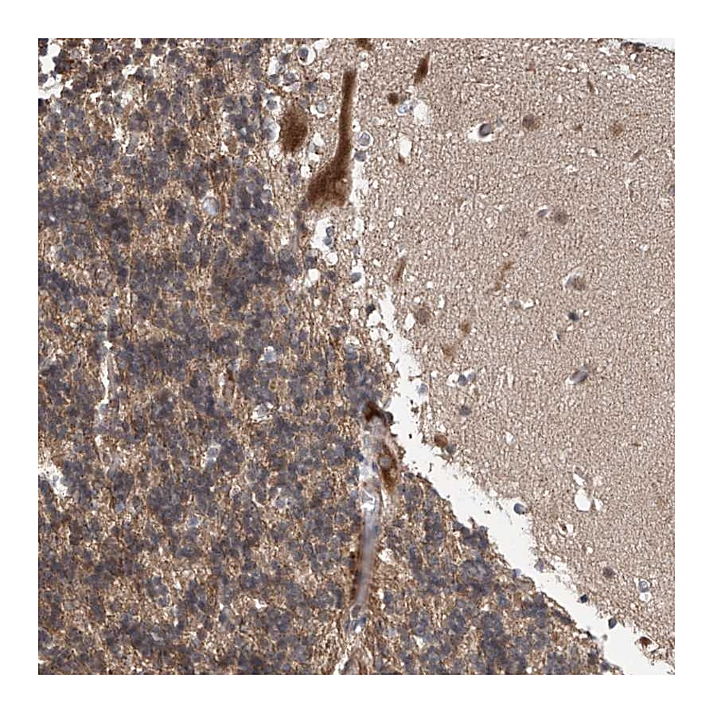 Atlas Antibodies Anti-ABHD13 Antibody